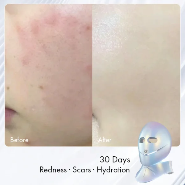 Chouchou Radiance LED Mask - Image 4